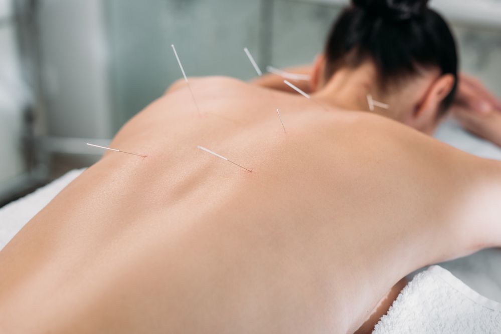 how-often-should-you-schedule-acupuncture-treatments