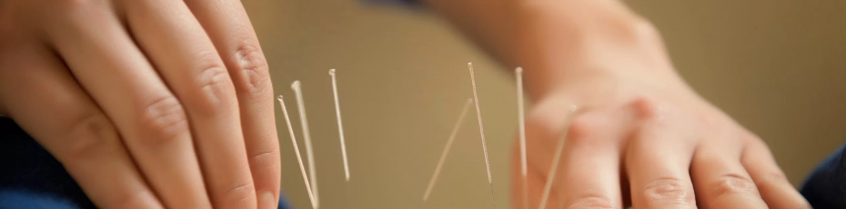 5-ways-acupuncture-can-promote-your-overall-health