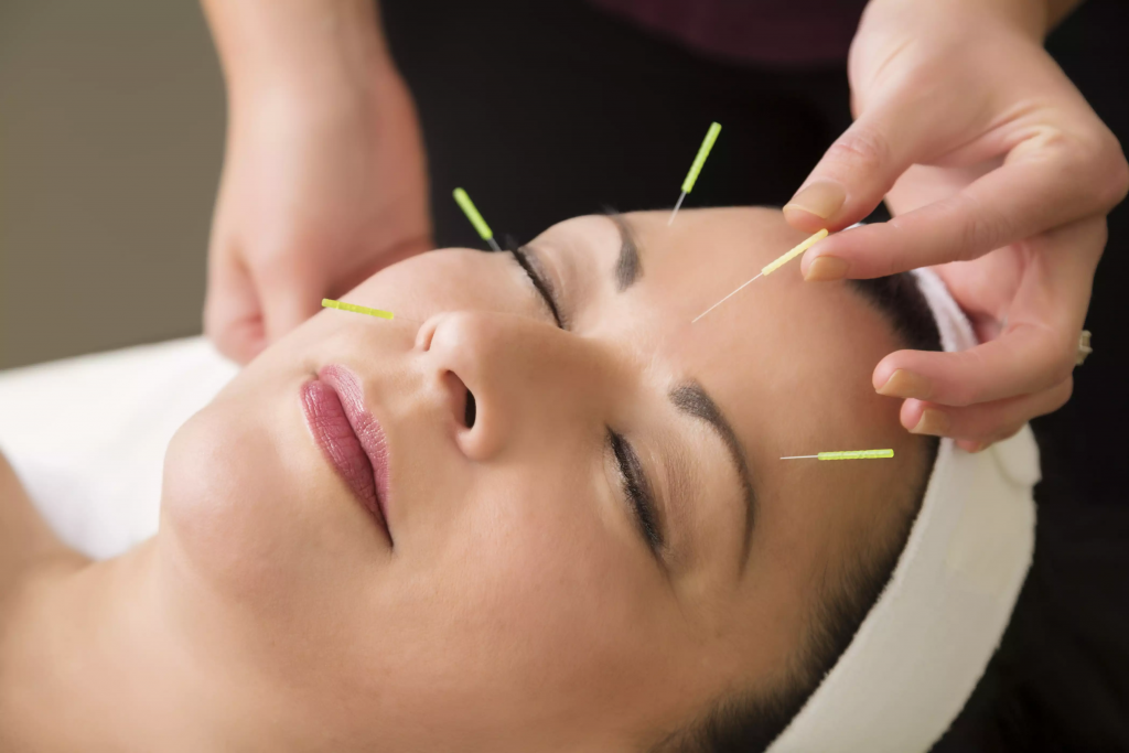 Can You Treat Anxiety and Depression With Acupuncture