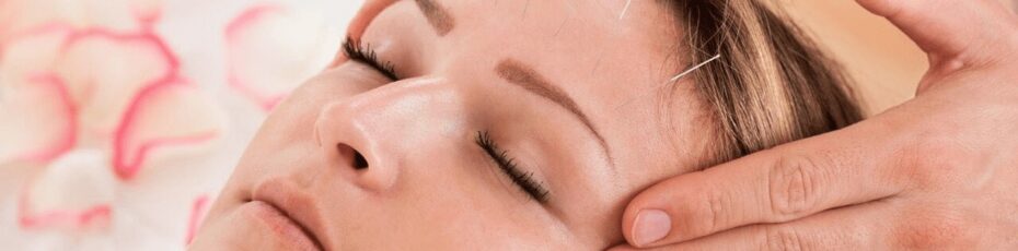 Benefits of Acupuncture For Headaches