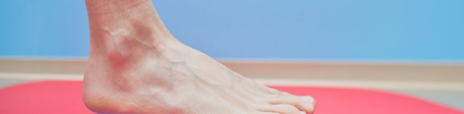 Choosing the Right Orthotics A Step-by-Step Guide