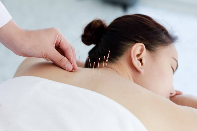 What Should I Expect At My First Acupuncture Visit?