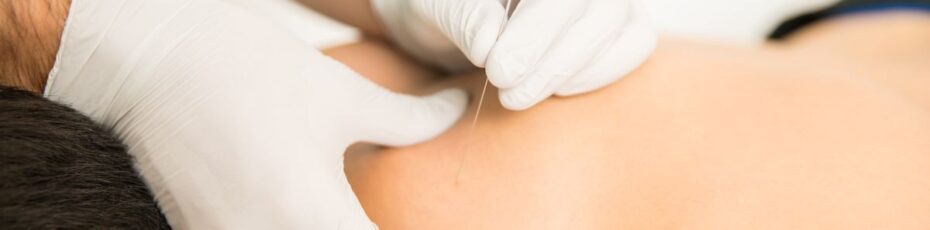 acupuncture in calgary sw