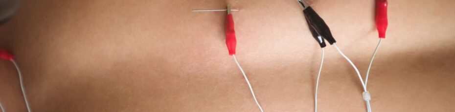 acupuncture clinic near you