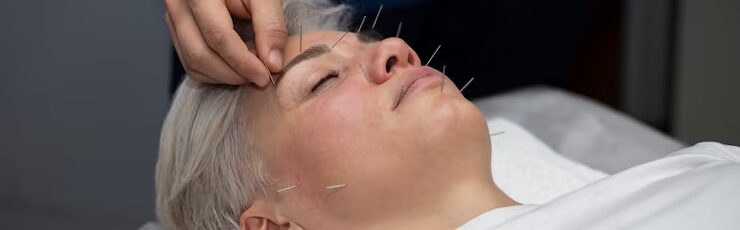 How often should you get acupuncture expert recommendations